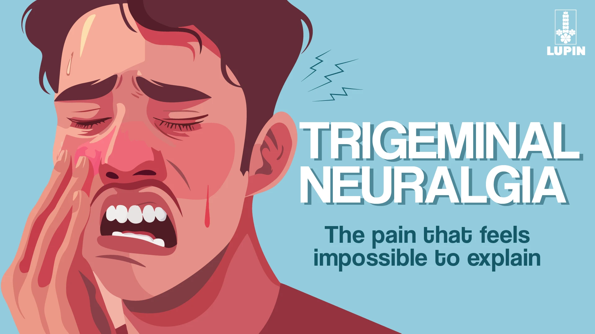 Trigeminal Neuralgia